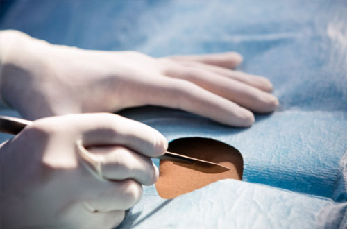 Kits UM Descartables